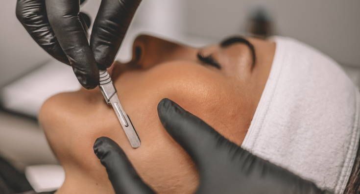 Glowing, refined skin after dermaplaning and LED therapy
